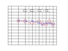 conductive hearing loss