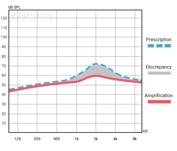 real ear measurement result