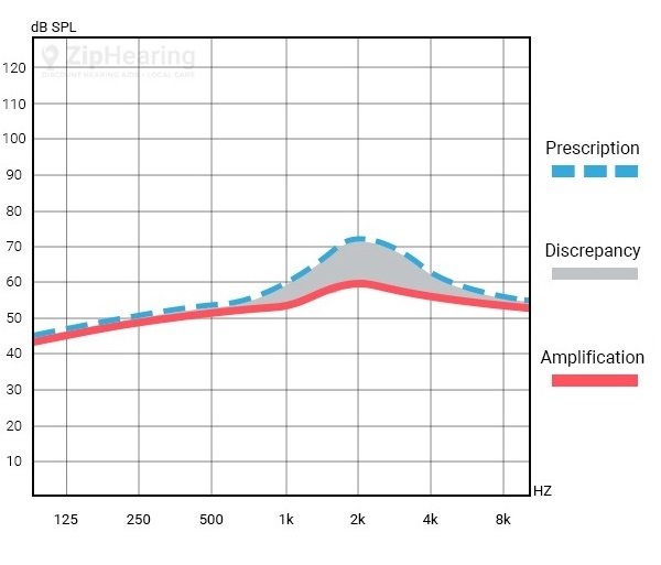 Real Ear Measurement ZipHearing