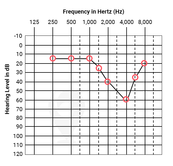 Noise notch audiogram indicative of noise induced hearing loss